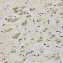Anti-MPS1 antibody used in IHC (Paraffin sections) (IHC-P). GTX32727