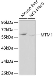 Anti-MTM1 antibody used in Western Blot (WB). GTX32731