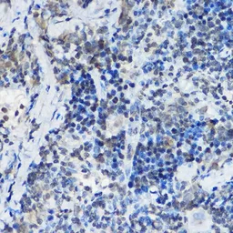 Anti-MYBBP1A antibody used in Immunocytochemistry/ Immunofluorescence (ICC/IF). GTX32732