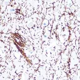 Anti-Myelin basic protein antibody used in IHC (Paraffin sections) (IHC-P). GTX32733