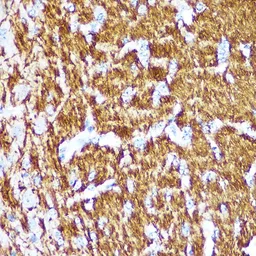 Anti-Myelin basic protein antibody used in IHC (Paraffin sections) (IHC-P). GTX32733