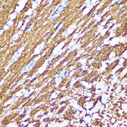 Anti-Myelin basic protein antibody used in IHC (Paraffin sections) (IHC-P). GTX32733
