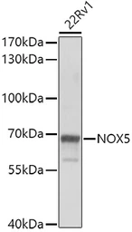 Anti-NADPH oxidase 5 antibody used in Western Blot (WB). GTX32735