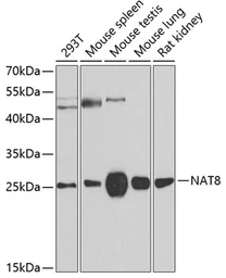 Anti-NAT8 antibody used in Western Blot (WB). GTX32737