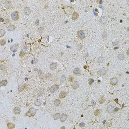 Anti-NAT8 antibody used in IHC (Paraffin sections) (IHC-P). GTX32737