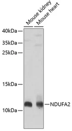 Anti-NDUFA2 antibody used in Western Blot (WB). GTX32741