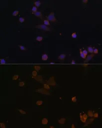 Anti-NDUFA2 antibody used in Immunocytochemistry/ Immunofluorescence (ICC/IF). GTX32741