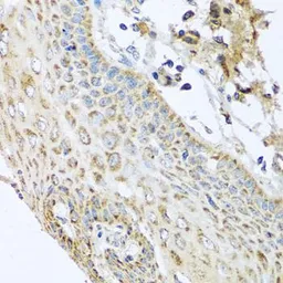 Anti-NDUFA2 antibody used in IHC (Paraffin sections) (IHC-P). GTX32741