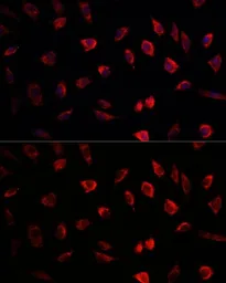 Anti-NEDD1 antibody used in Immunocytochemistry/ Immunofluorescence (ICC/IF). GTX32744