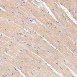 Anti-NHLRC1 antibody used in IHC (Paraffin sections) (IHC-P). GTX32750