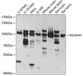 Anti-NLGN4Y antibody used in Western Blot (WB). GTX32753