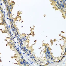Anti-NLGN4Y antibody used in IHC (Paraffin sections) (IHC-P). GTX32753
