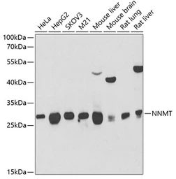 Anti-NNMT antibody used in Western Blot (WB). GTX32754
