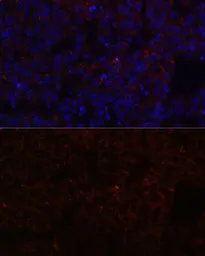 Anti-NNMT antibody used in IHC (Paraffin sections) (IHC-P). GTX32754