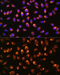 Anti-NQO1 antibody used in Immunocytochemistry/ Immunofluorescence (ICC/IF). GTX32756