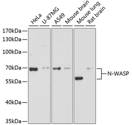 Anti-N-WASP antibody used in Western Blot (WB). GTX32762