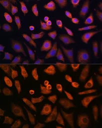 Anti-N-WASP antibody used in Immunocytochemistry/ Immunofluorescence (ICC/IF). GTX32762