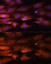 Anti-N-WASP antibody used in Immunocytochemistry/ Immunofluorescence (ICC/IF). GTX32762