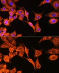 Anti-N-WASP antibody used in Immunocytochemistry/ Immunofluorescence (ICC/IF). GTX32762