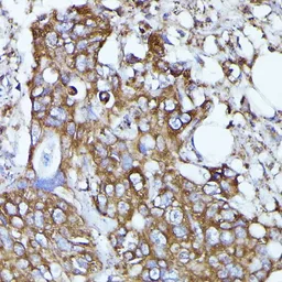 Anti-N-WASP antibody used in IHC (Paraffin sections) (IHC-P). GTX32762
