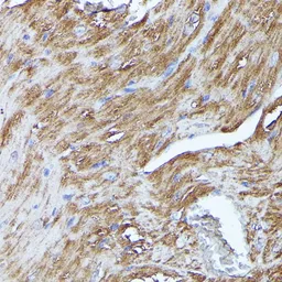 Anti-N-WASP antibody used in IHC (Paraffin sections) (IHC-P). GTX32762