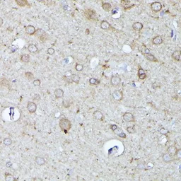 Anti-N-WASP antibody used in IHC (Paraffin sections) (IHC-P). GTX32762