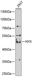 Anti-NYX antibody used in Western Blot (WB). GTX32763