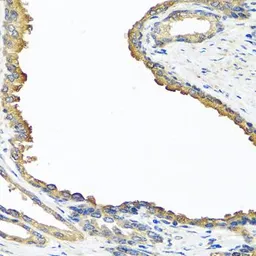 Anti-NYX antibody used in IHC (Paraffin sections) (IHC-P). GTX32763
