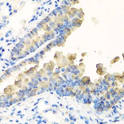 Anti-NYX antibody used in IHC (Paraffin sections) (IHC-P). GTX32763
