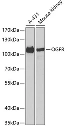 Anti-Zeta Opioid Receptor antibody used in Western Blot (WB). GTX32765