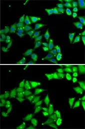 Anti-Zeta Opioid Receptor antibody used in Immunocytochemistry/ Immunofluorescence (ICC/IF). GTX32765