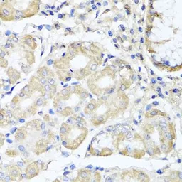 Anti-OPA3 antibody used in IHC (Paraffin sections) (IHC-P). GTX32767