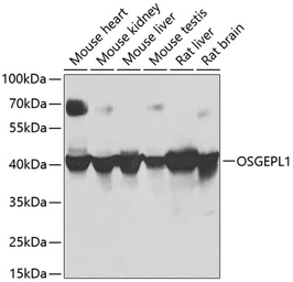 Anti-OSGEPL1 antibody used in Western Blot (WB). GTX32768