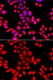 Anti-OSGEPL1 antibody used in Immunocytochemistry/ Immunofluorescence (ICC/IF). GTX32768