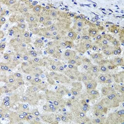 Anti-OSGEPL1 antibody used in IHC (Paraffin sections) (IHC-P). GTX32768