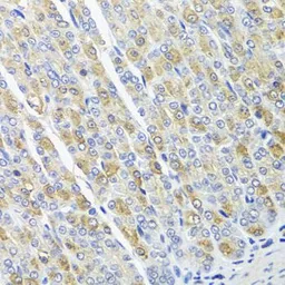 Anti-OSGEPL1 antibody used in IHC (Paraffin sections) (IHC-P). GTX32768