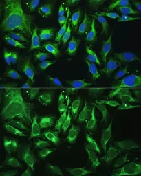 Anti-Osteoglycin antibody used in Immunocytochemistry/ Immunofluorescence (ICC/IF). GTX32769