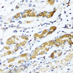Anti-Osteoglycin antibody used in IHC (Paraffin sections) (IHC-P). GTX32769