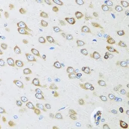 Anti-Osteoglycin antibody used in IHC (Paraffin sections) (IHC-P). GTX32769