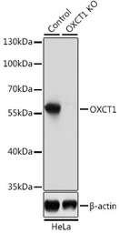 Anti-OXCT1 antibody used in Western Blot (WB). GTX32770