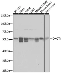 Anti-OXCT1 antibody used in Western Blot (WB). GTX32770
