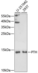 Anti-Parathyroid Hormone antibody used in Western Blot (WB). GTX32772