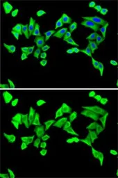 Anti-Parathyroid Hormone antibody used in Immunocytochemistry/ Immunofluorescence (ICC/IF). GTX32772