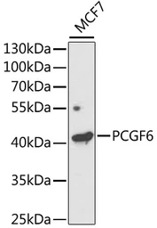 Anti-PCGF6 antibody used in Western Blot (WB). GTX32775