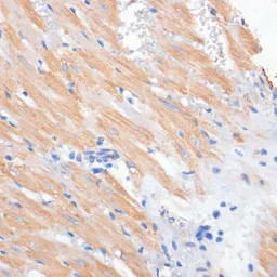 Anti-PDCD2L antibody used in IHC (Paraffin sections) (IHC-P). GTX32776