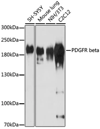 Anti-PDGF Receptor beta antibody used in Western Blot (WB). GTX32777