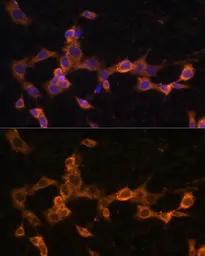 Anti-PDGF Receptor beta antibody used in Immunocytochemistry/ Immunofluorescence (ICC/IF). GTX32777