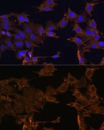 Anti-PDGF Receptor beta antibody used in Immunocytochemistry/ Immunofluorescence (ICC/IF). GTX32777