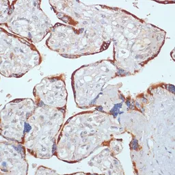 Anti-PDGF Receptor beta antibody used in IHC (Paraffin sections) (IHC-P). GTX32777