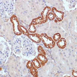 Anti-PDGF Receptor beta antibody used in IHC (Paraffin sections) (IHC-P). GTX32777